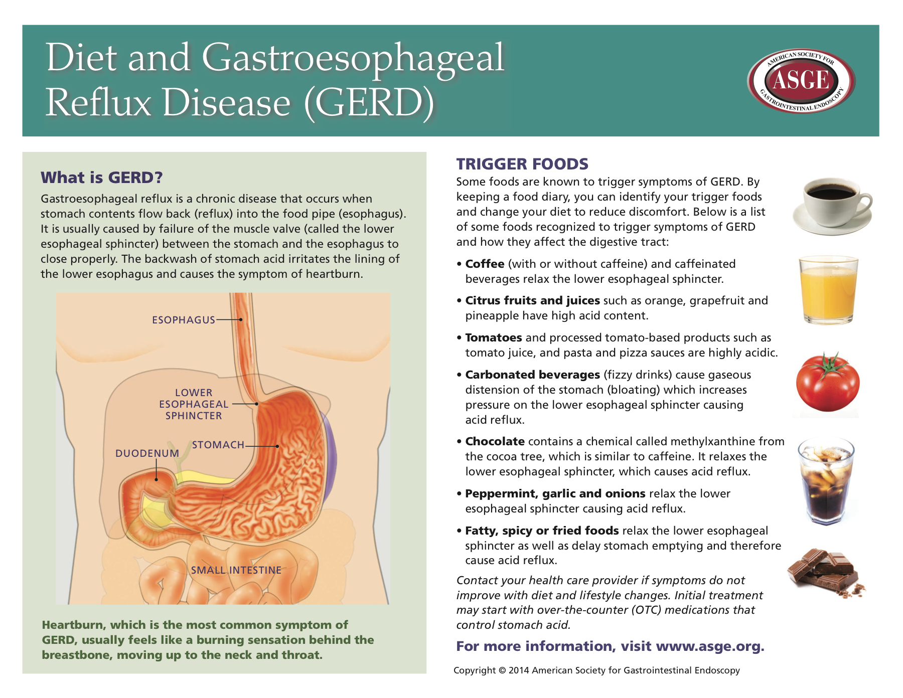 asge | infographic: diet and gastroesophageal reflux disease (gerd)