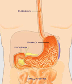 GERD3