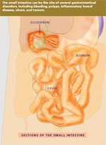 Capsule Endoscopy image