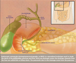 ERCP illus 1