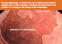 ASGE | Understanding Barrett's Esophagus